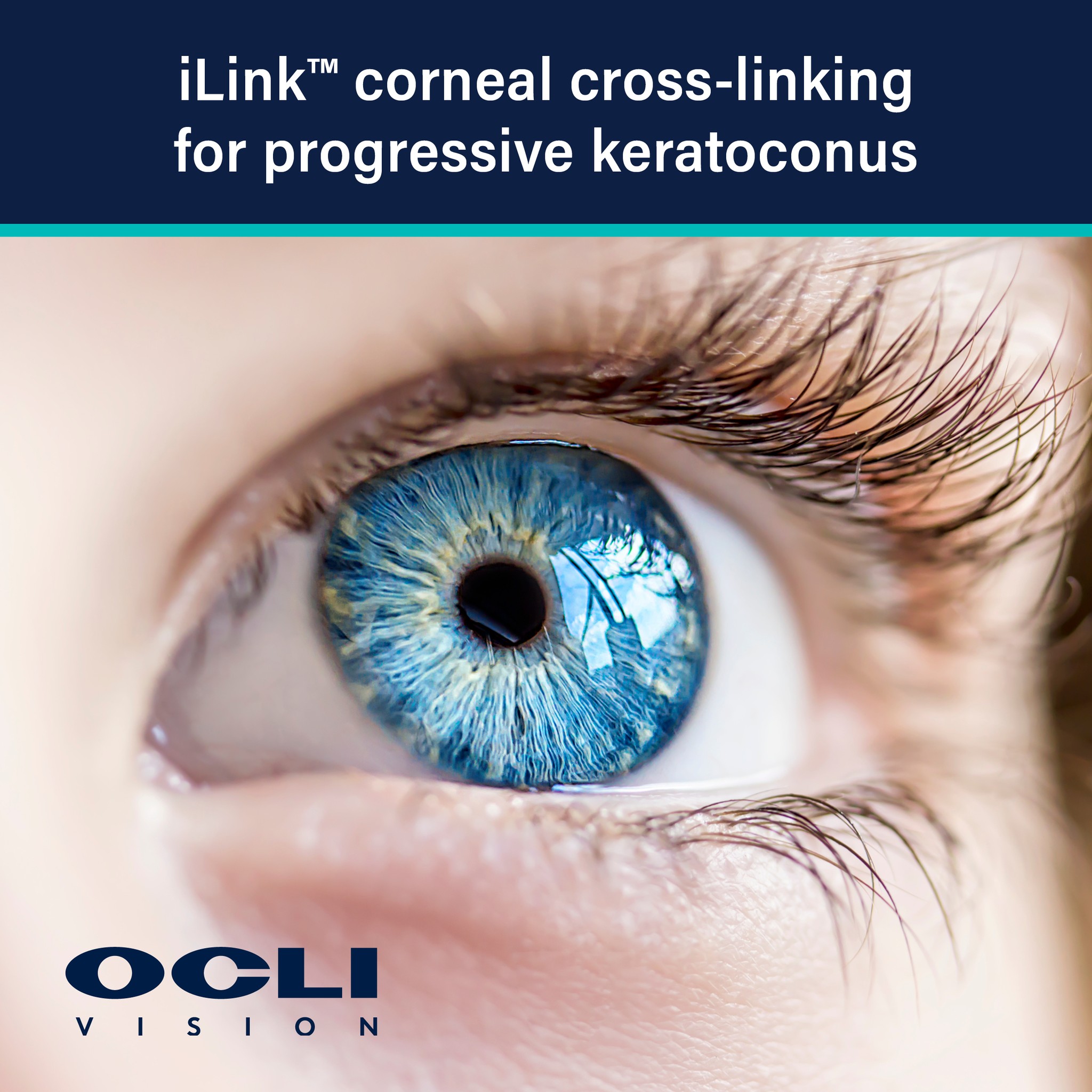 OCLI Vision - Here at OCLI Vision we’re always working to... | Facebook