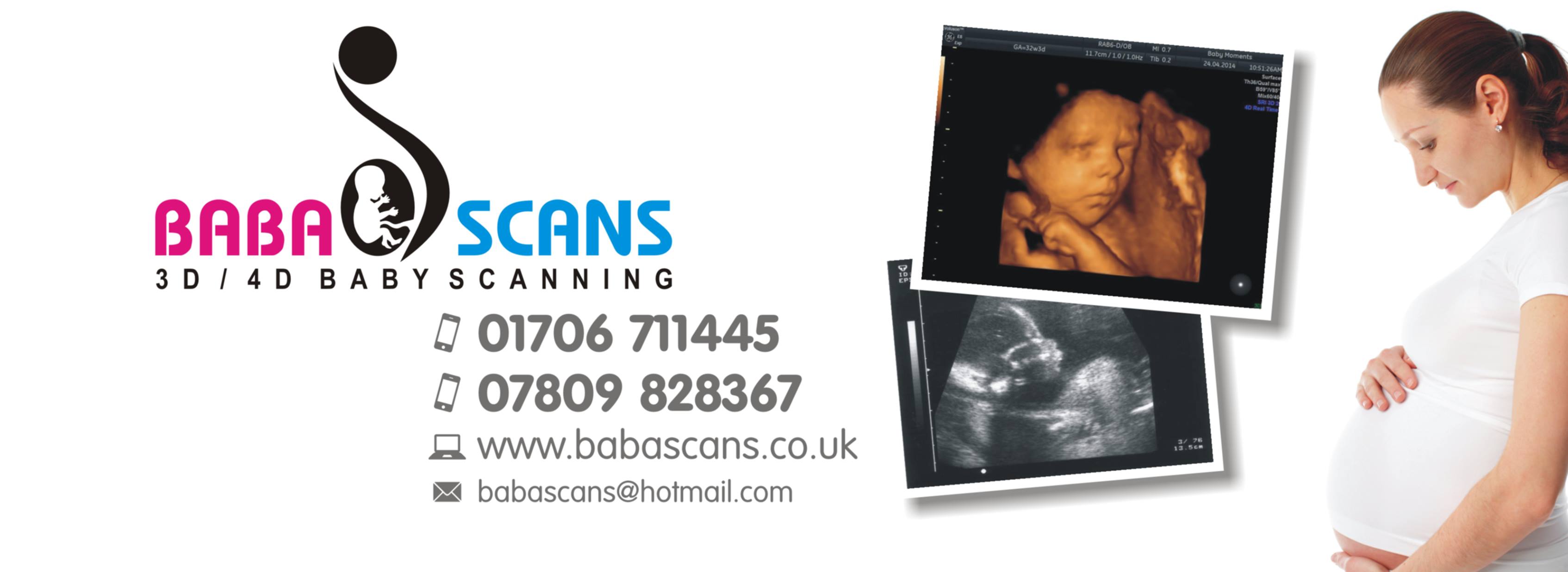 Baba Scans- 3D/4D Baby Scanning | Rochdale