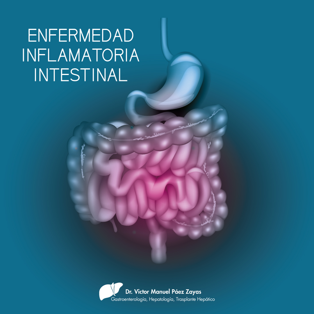 Enfermedad... - Dr. Páez/Gastro, Hepatología y Trasplante