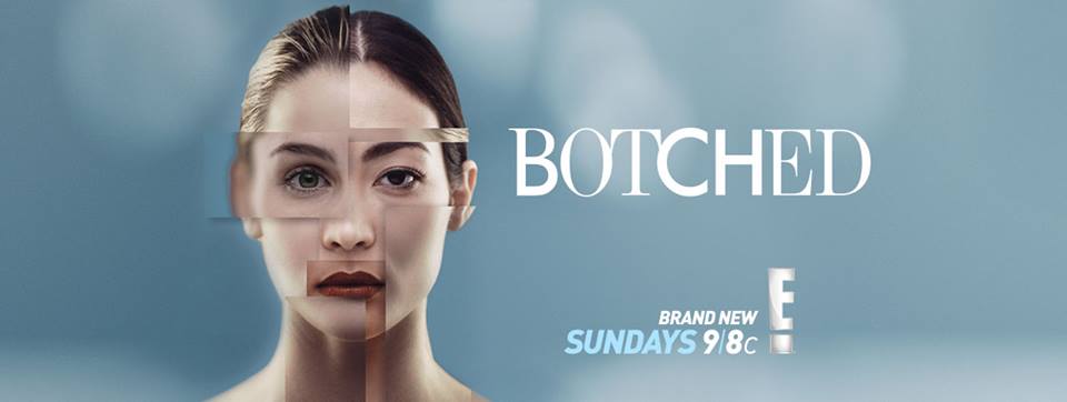 Botched - Kelly was born with a cleft lip and palette. Her lip and ...