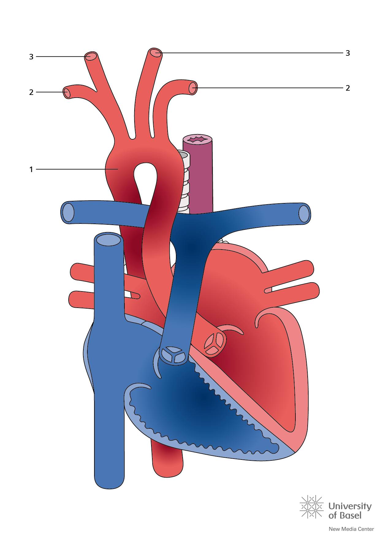 Tiny - What is Right Aortic Arch? Right Aortic Arch (RAA) is a type of ...