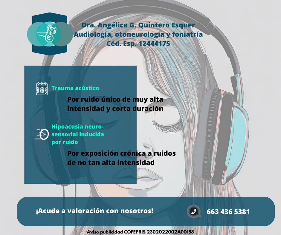 Audio - * SORDERA POR RUIDO * Las hipoacusias inducidas por ruido son ...