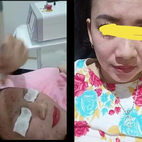 Jangan bilang batrisya itu gak... - Batrisya Herbal Sulsel