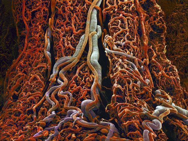 Daily Anatomy - Small Intestine Blood Vessels! This colored scanning ...