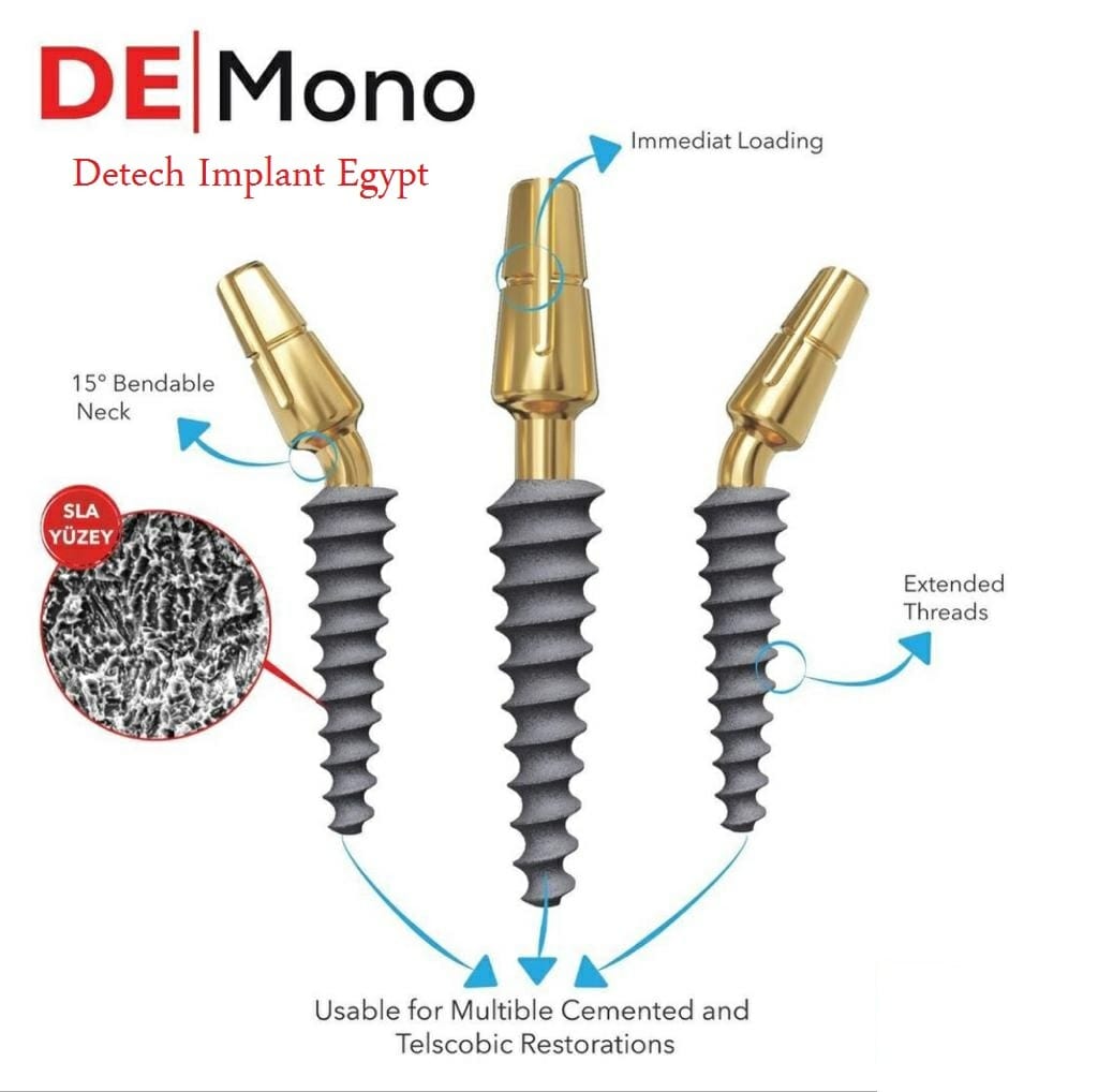 Detech - #comperssive_implant Available now 🔥👏 In detech implant Egypt ...