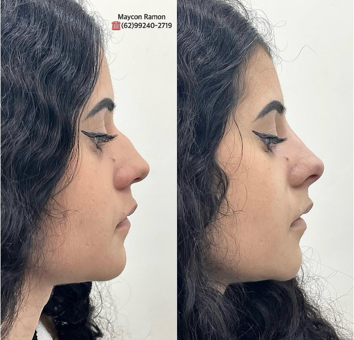 Dr. Maycon Ramon | Goiânia GO