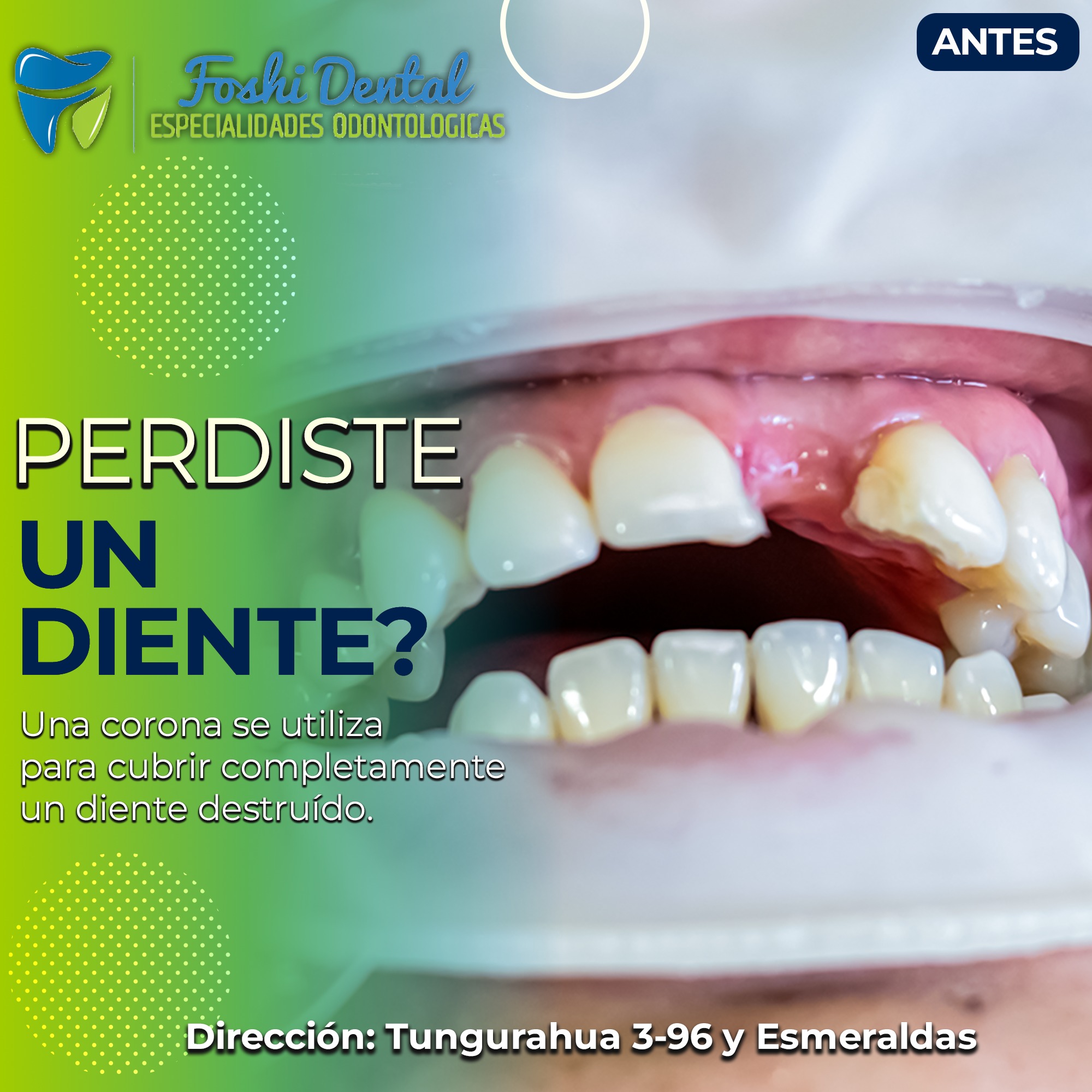 Foshi Dental | Cuenca
