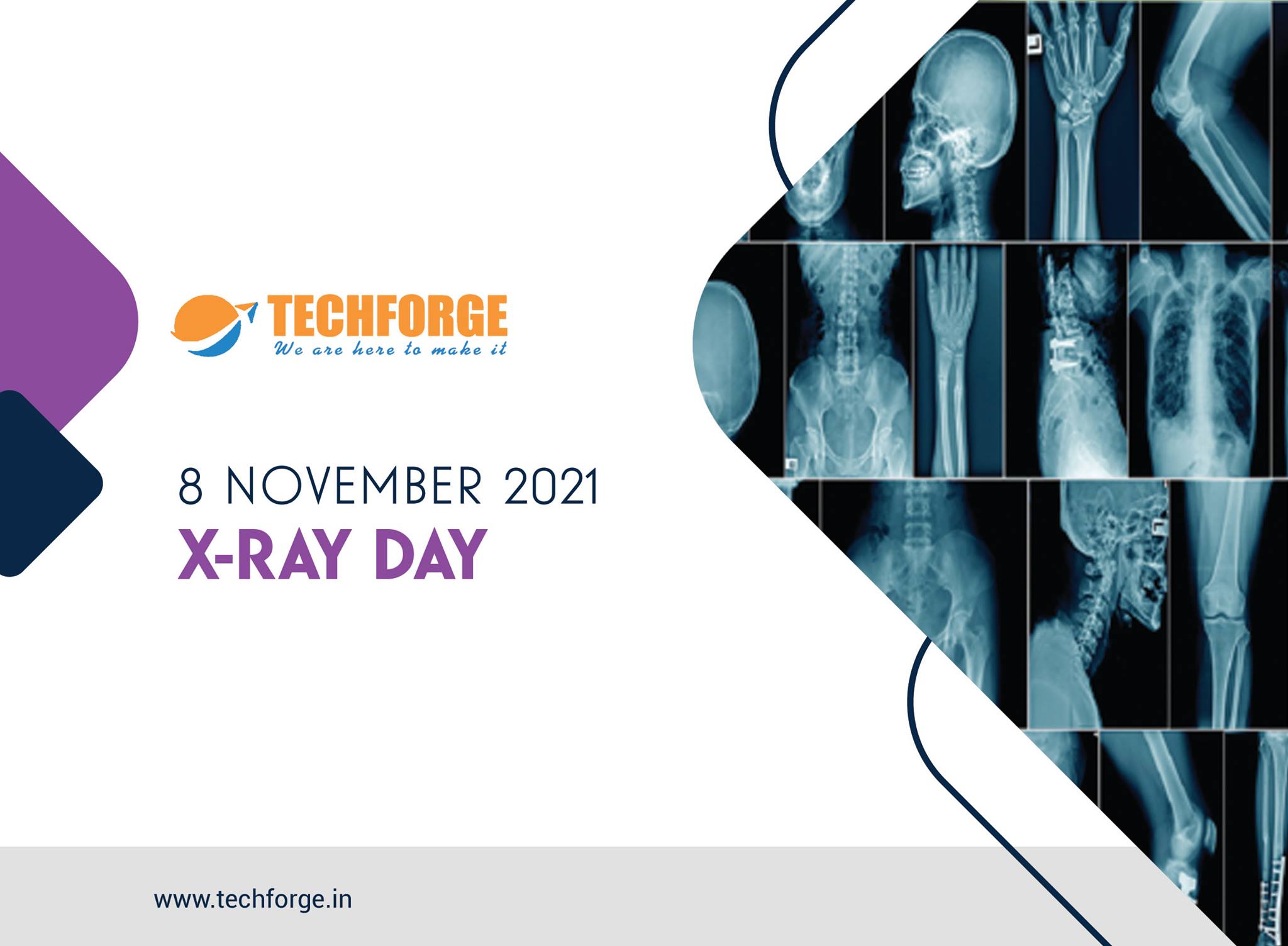 Techforge - X-Ray Day #xray #xraytech #xraylife #xrayspex | Facebook