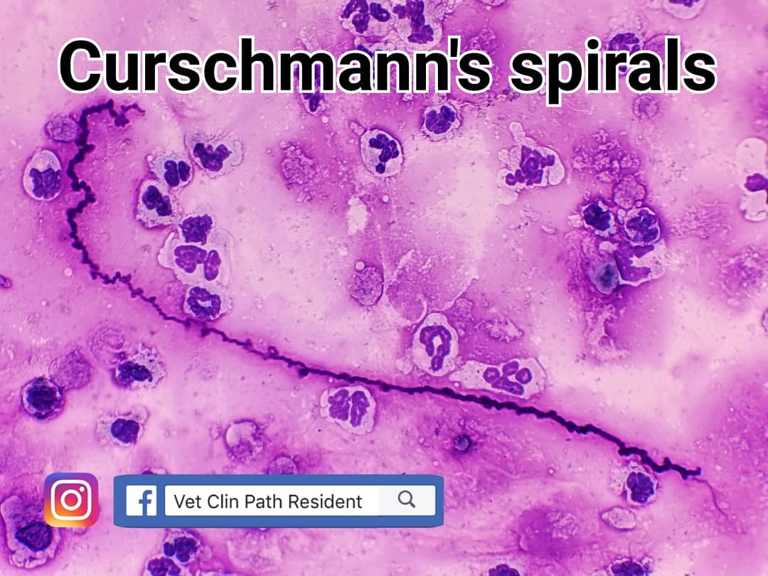 Vet - [Curschmann's spirals] Have you ever wonder what are these tube ...