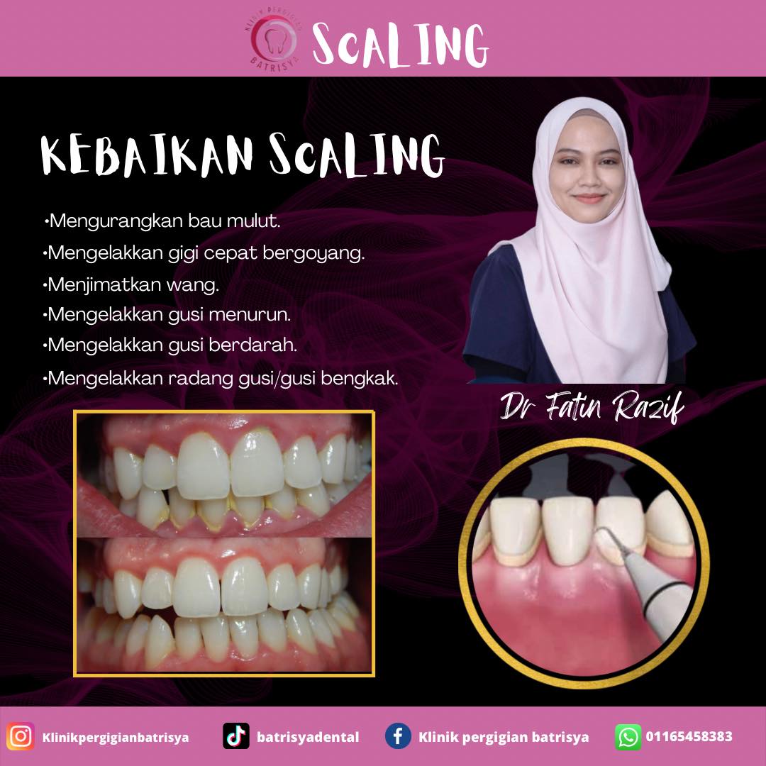 Korang yang tak scaling lagi... - Klinik Pergigian Batrisya | Facebook