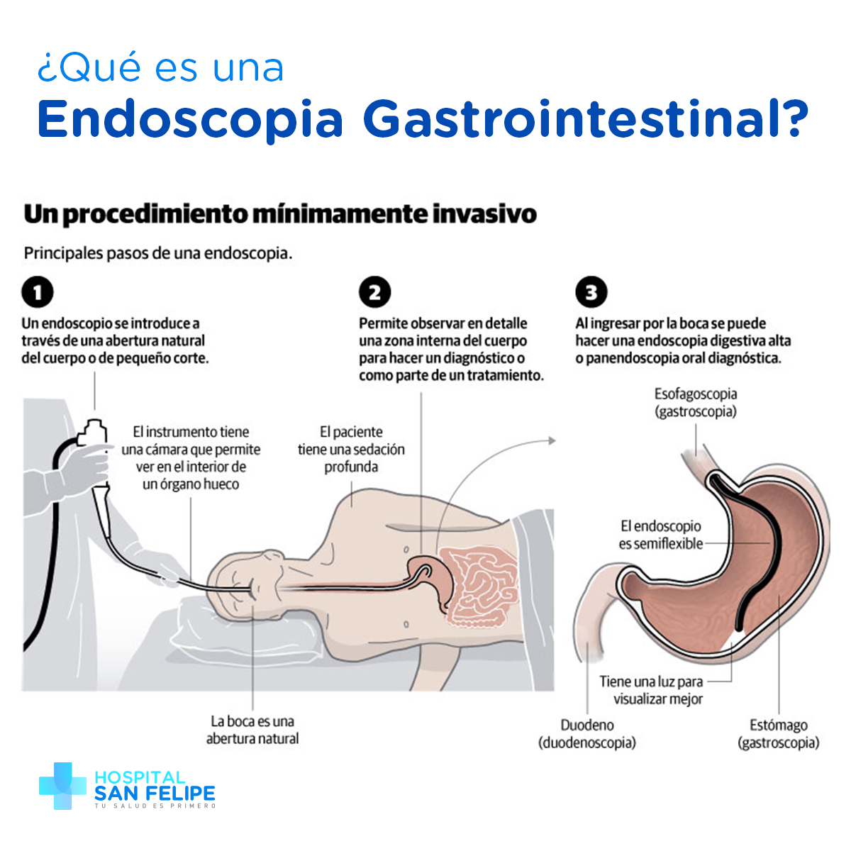 La endoscopia gastrointestinal puede... - Hospital San Felipe