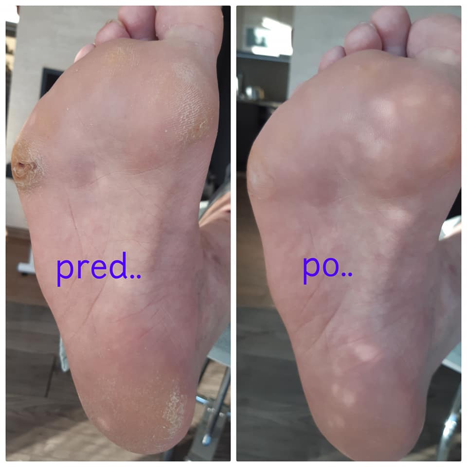 PediMan | Leziachov