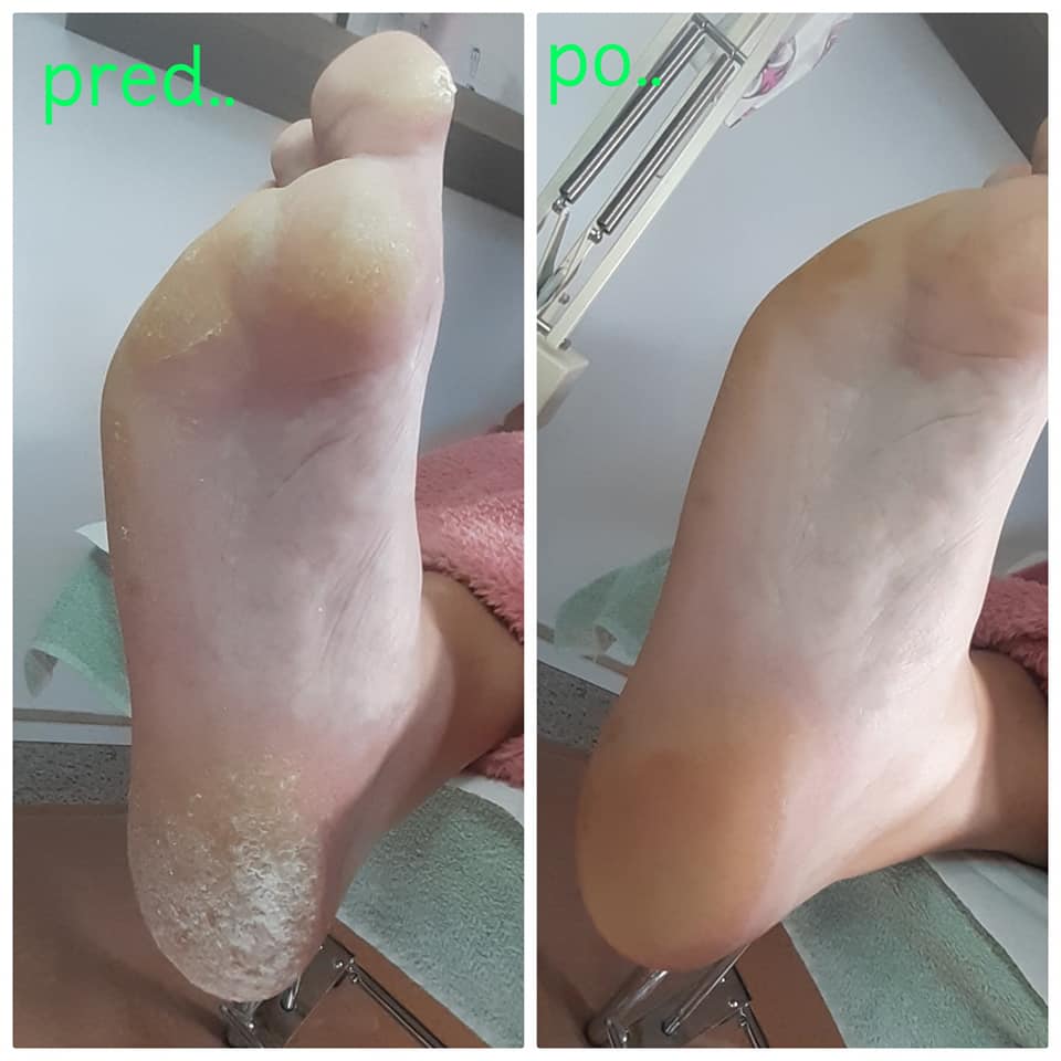 PediMan | Leziachov