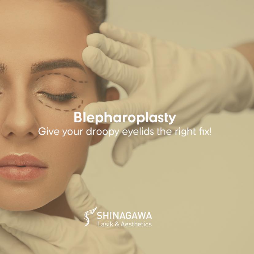 Give your droopy... - Shinagawa Aesthetics Philippines