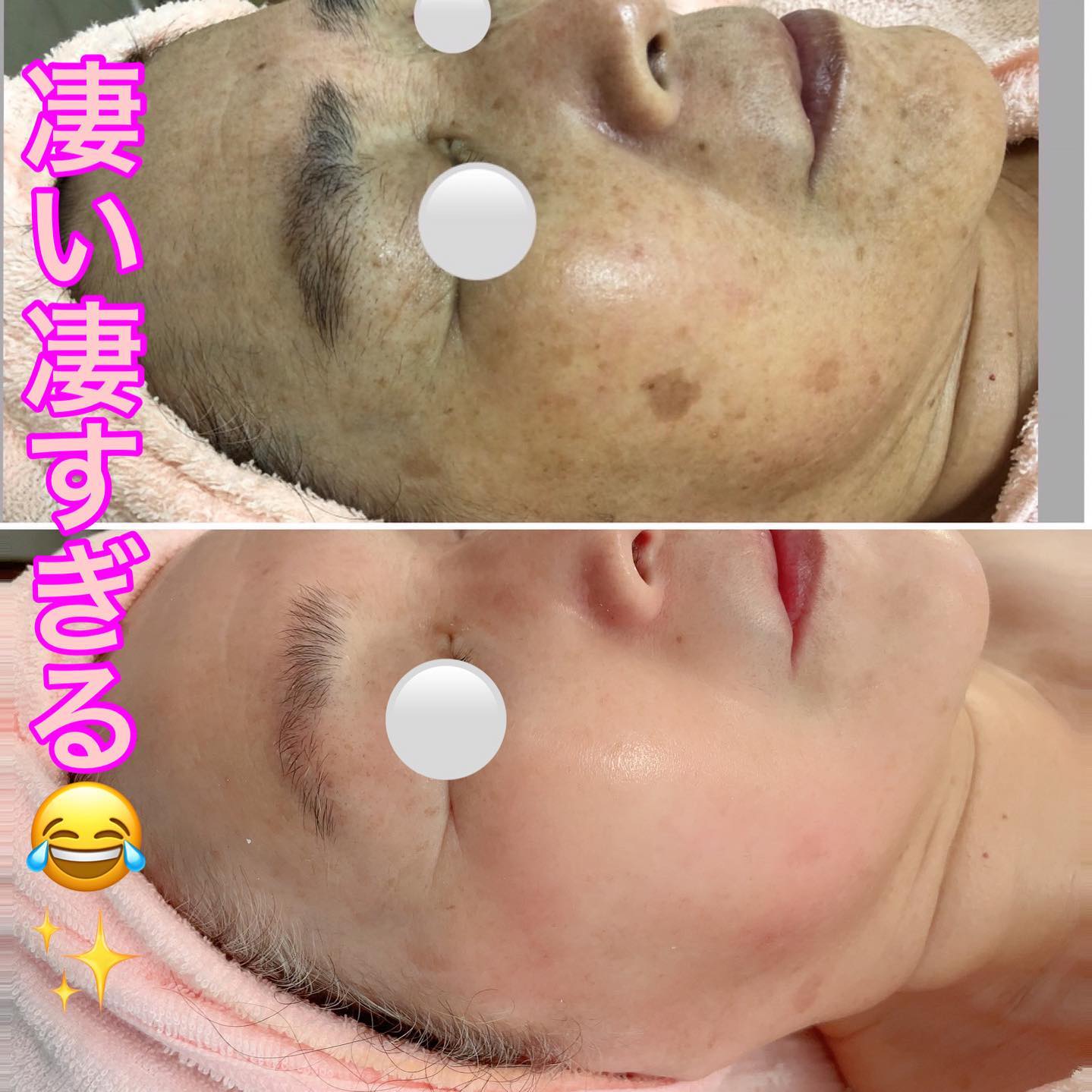バイキョン⭐︎キョンシャイニングセラム キョン先生 - やば 