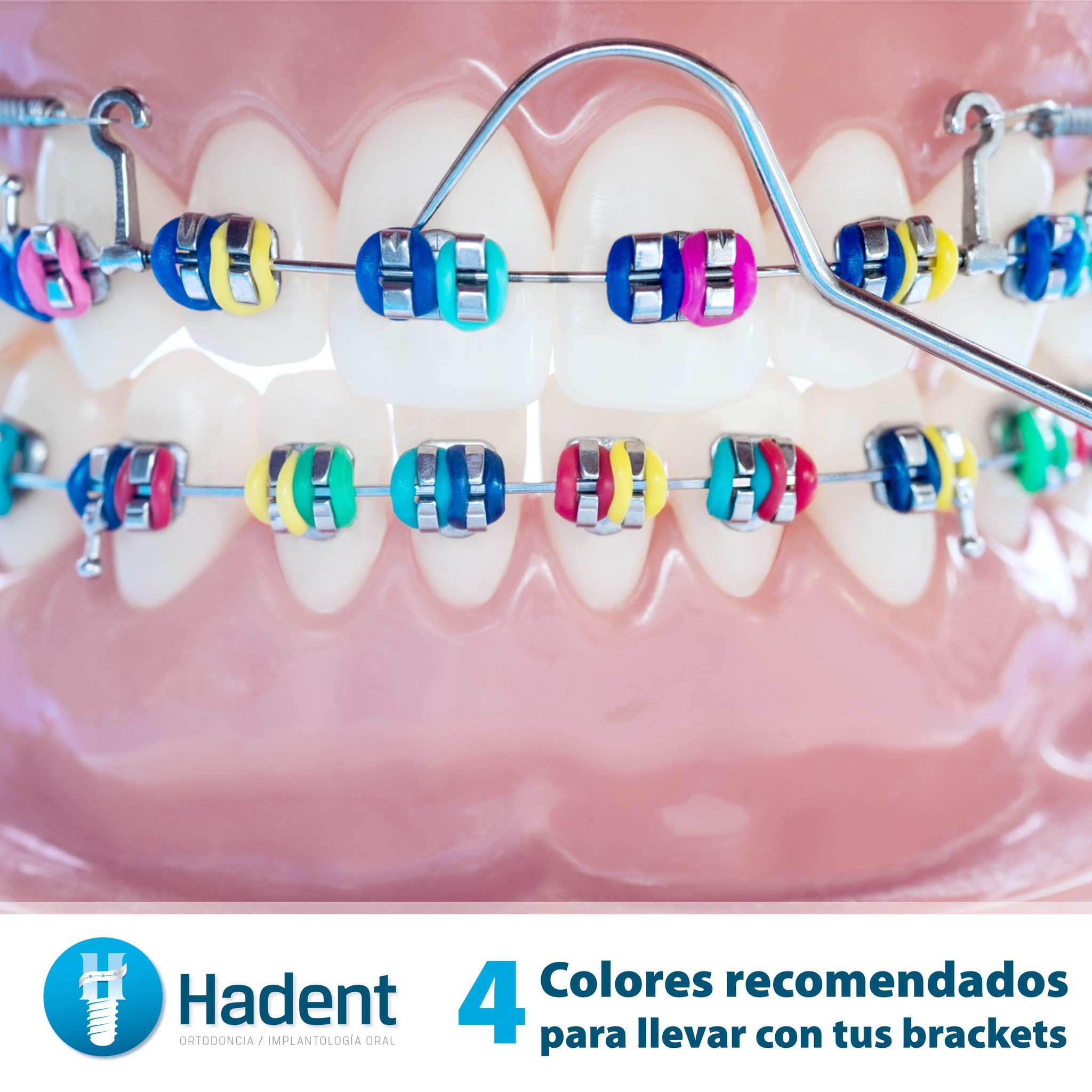 Hadent Clínicas Odontológicas - 🤩¿Sabías que puedes personalizar tu ...
