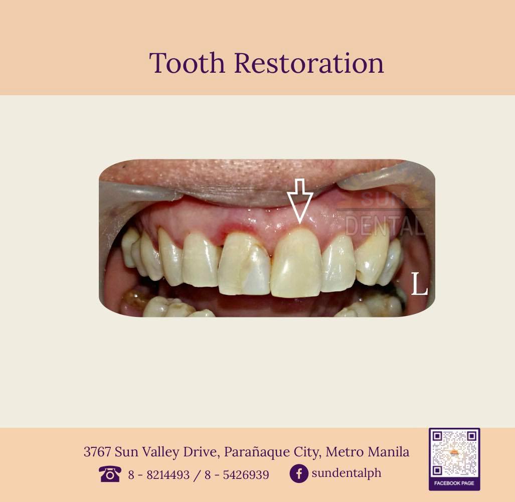 Sun Dental - Spot the difference. It’s time to change your old ...