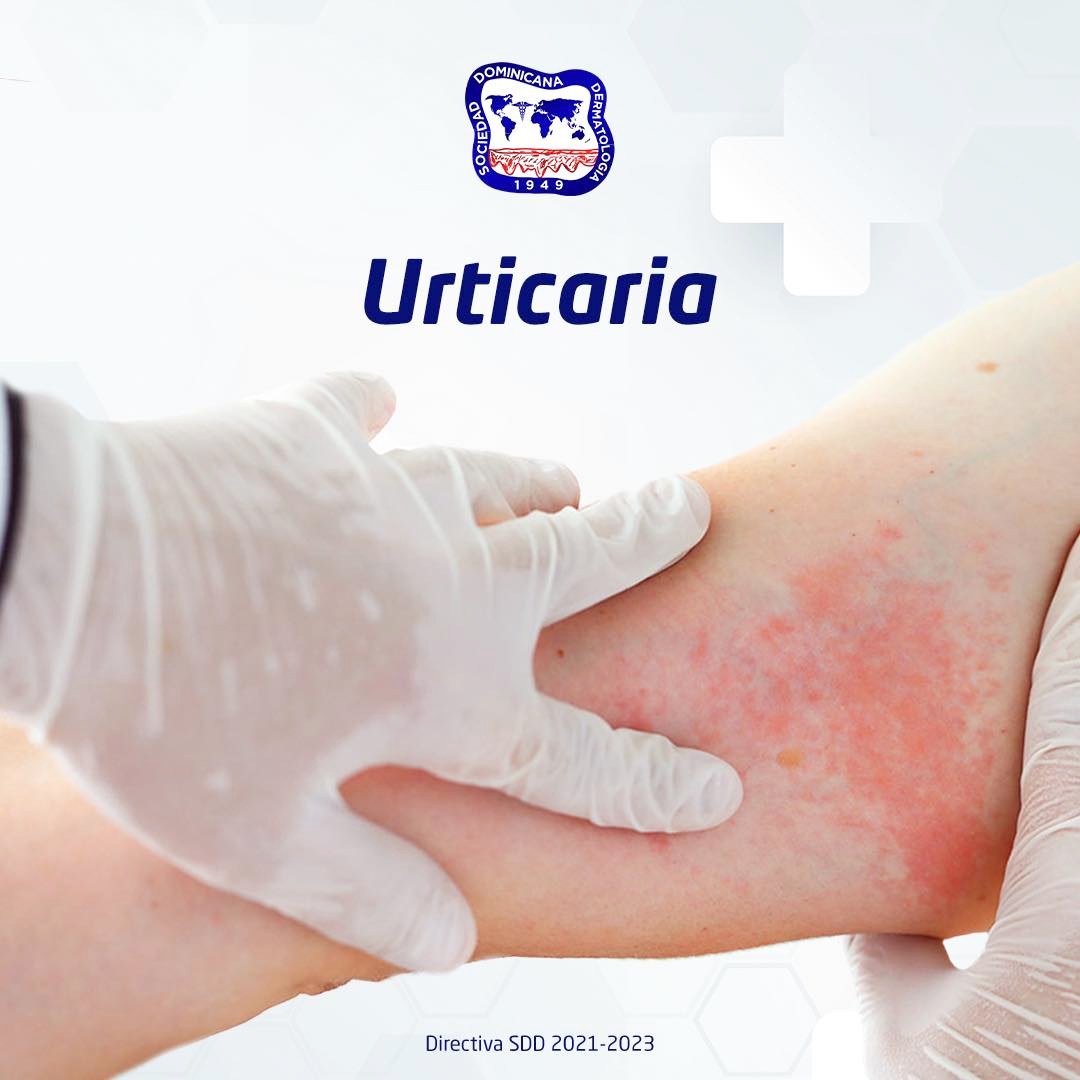 La urticaria son... - Sociedad Dominicana de Dermatología | Facebook