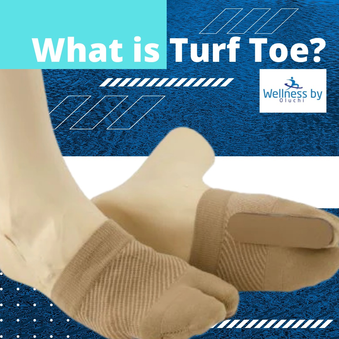 What is Turf Toe?🧐 Turf toe is a... - Wellness by Oluchi | Facebook