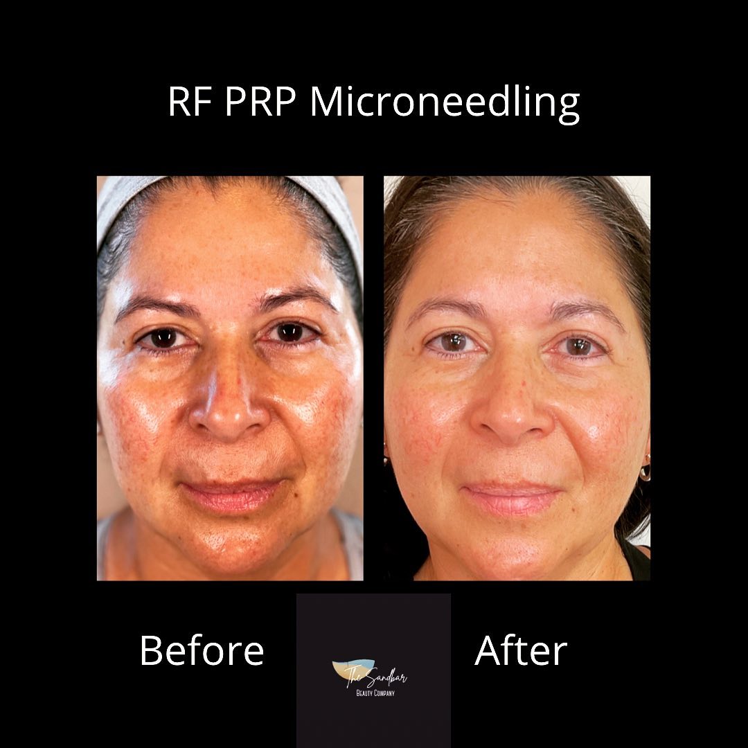 What is this magic?! This... - The Sandbar Beauty Company
