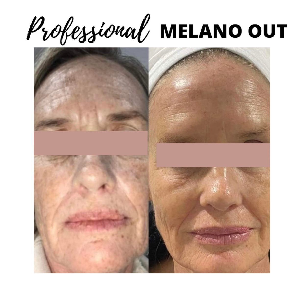 melano out glutathione face mask Seka's Volume:100mL kirkman labs reduced l-glutathione health powders