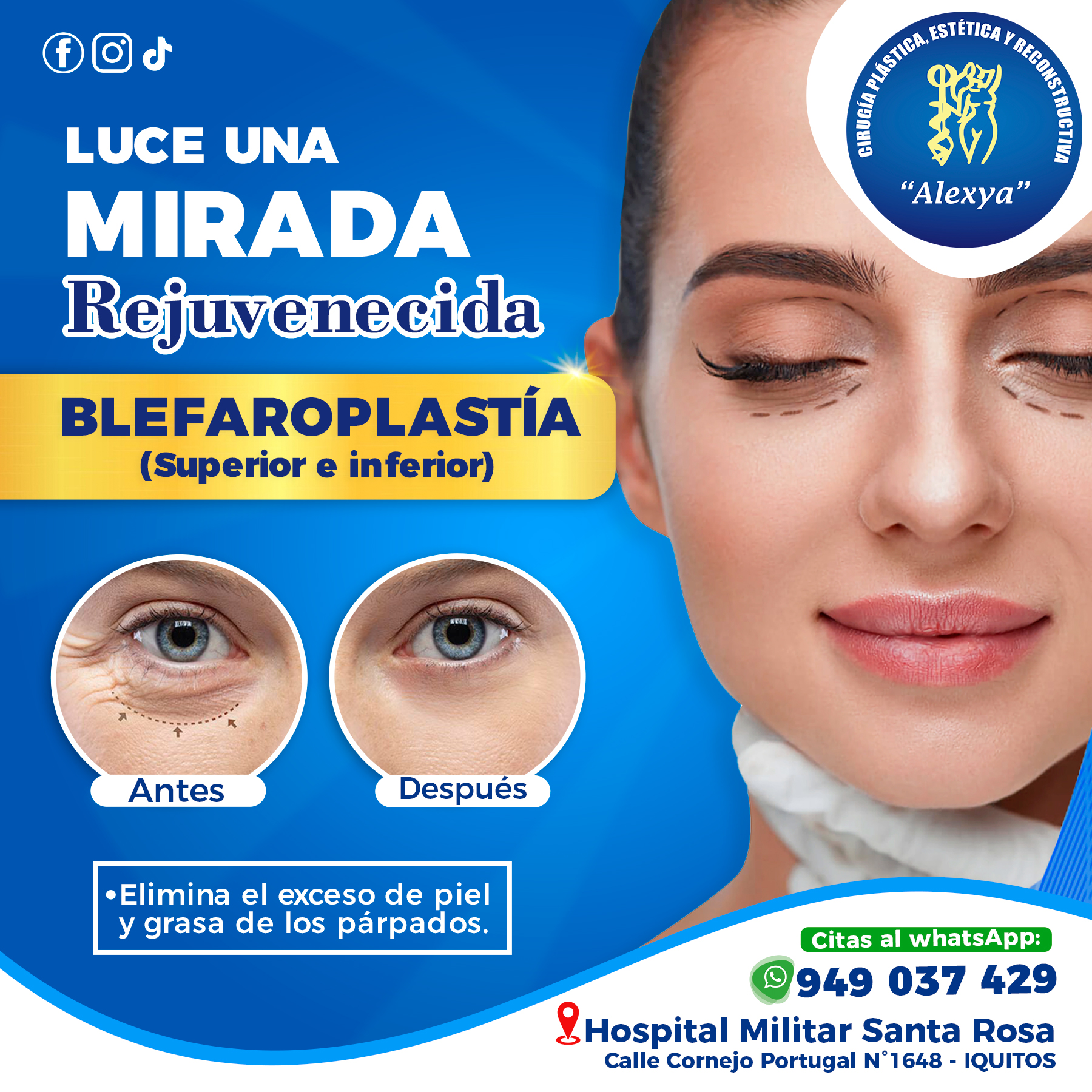 Cirugía - 🌟 ¡Renueva tu Mirada con Blefaroplastia Superior e Inferior ...