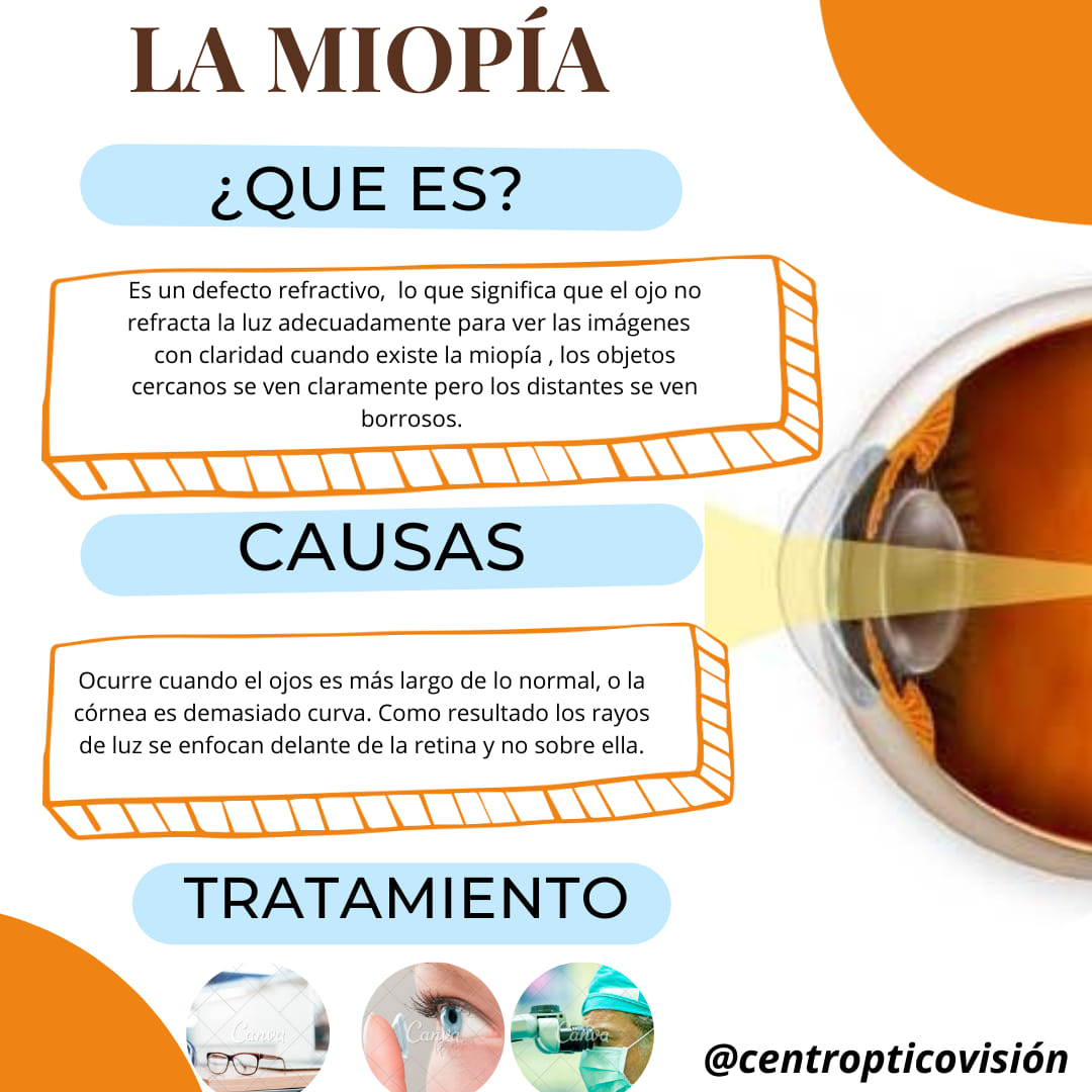 Diagnóstico Y Tratamiento De La Miopía – JQMCLV