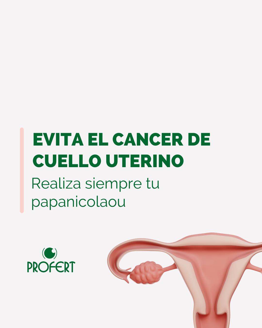 Profert - 🚨La prueba de Papanicolaou es un examen que... | Facebook