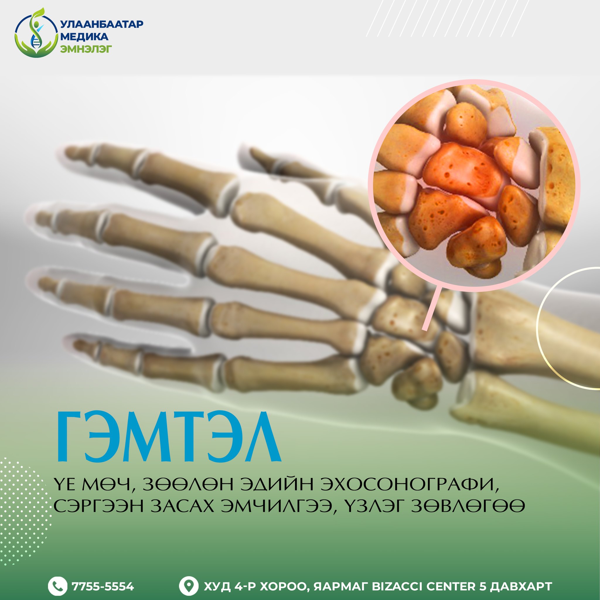 Улаанбаатар - Бугуйн өвдөлт ба Carpal tunnel syndrome хэрхэн үүсдэг вэ ...