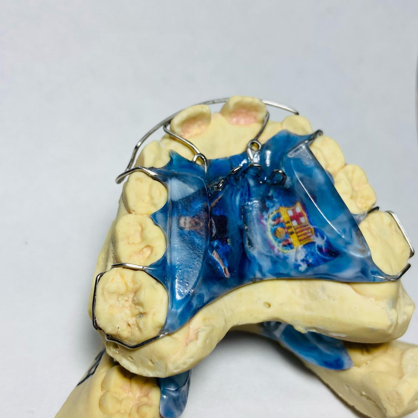 retainers_labdental