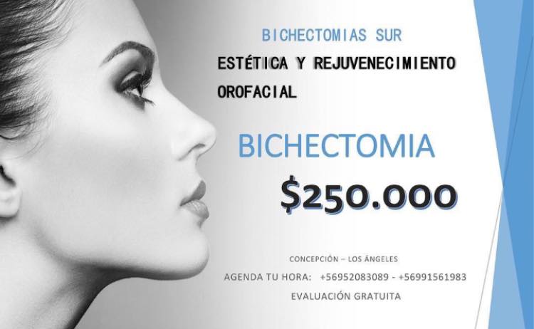 Dra. - #ATREVETE! Reduce arrugas perioculares o patas de gallo de ...