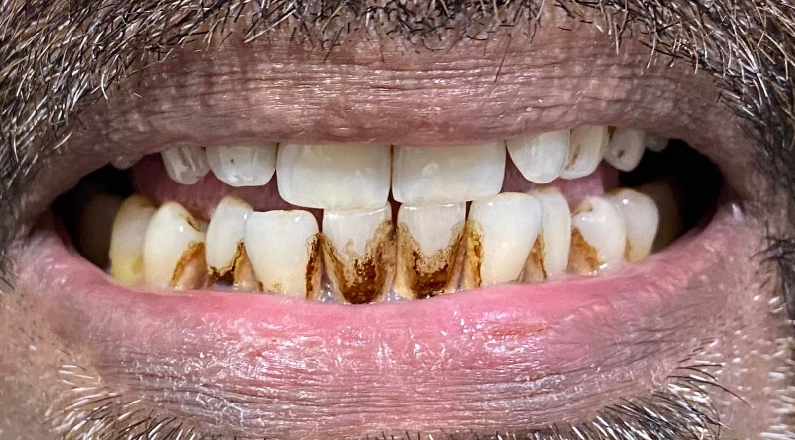dr-zain-dental-care-karachi