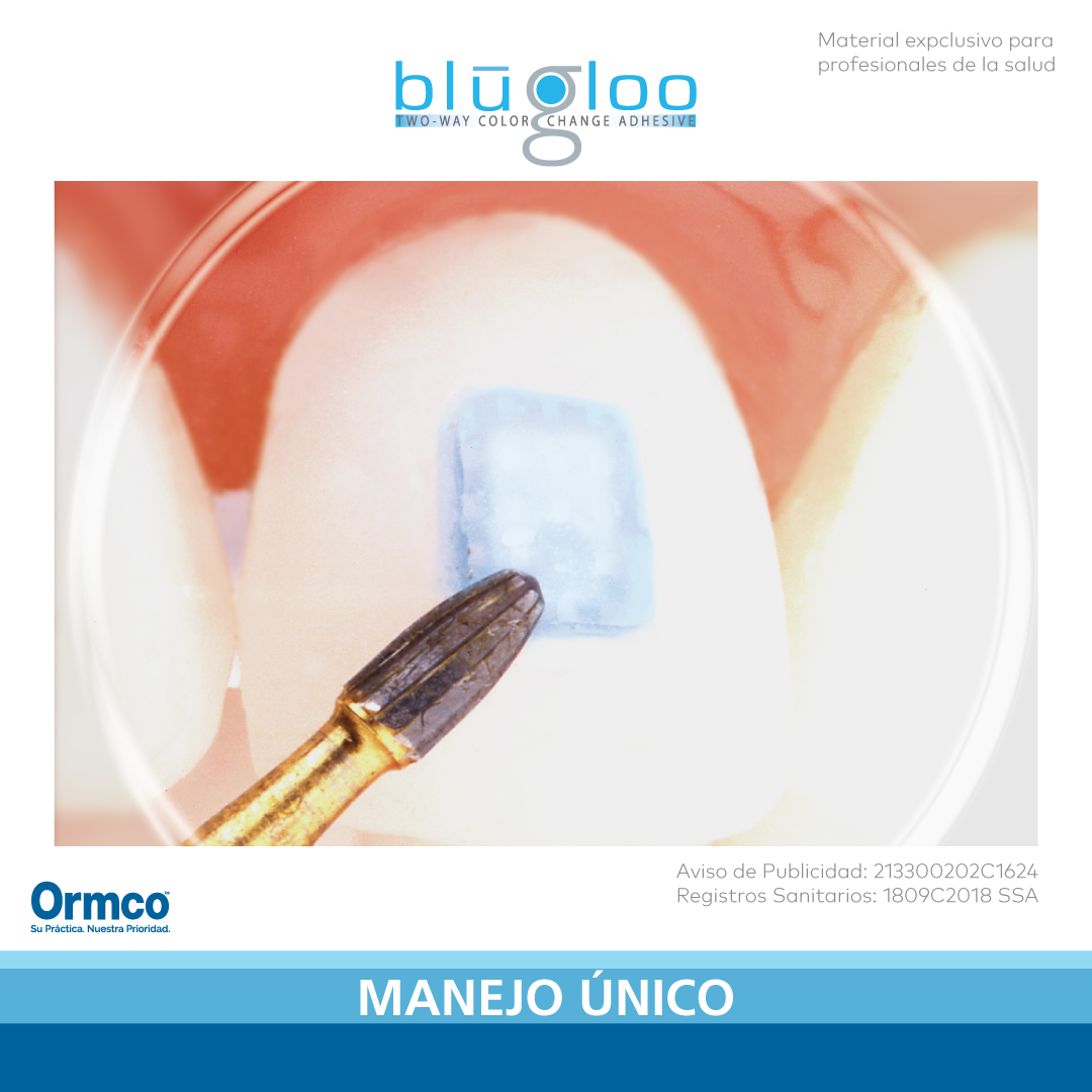 Ormco de México - Blügloo adhesivo con cambio de color...