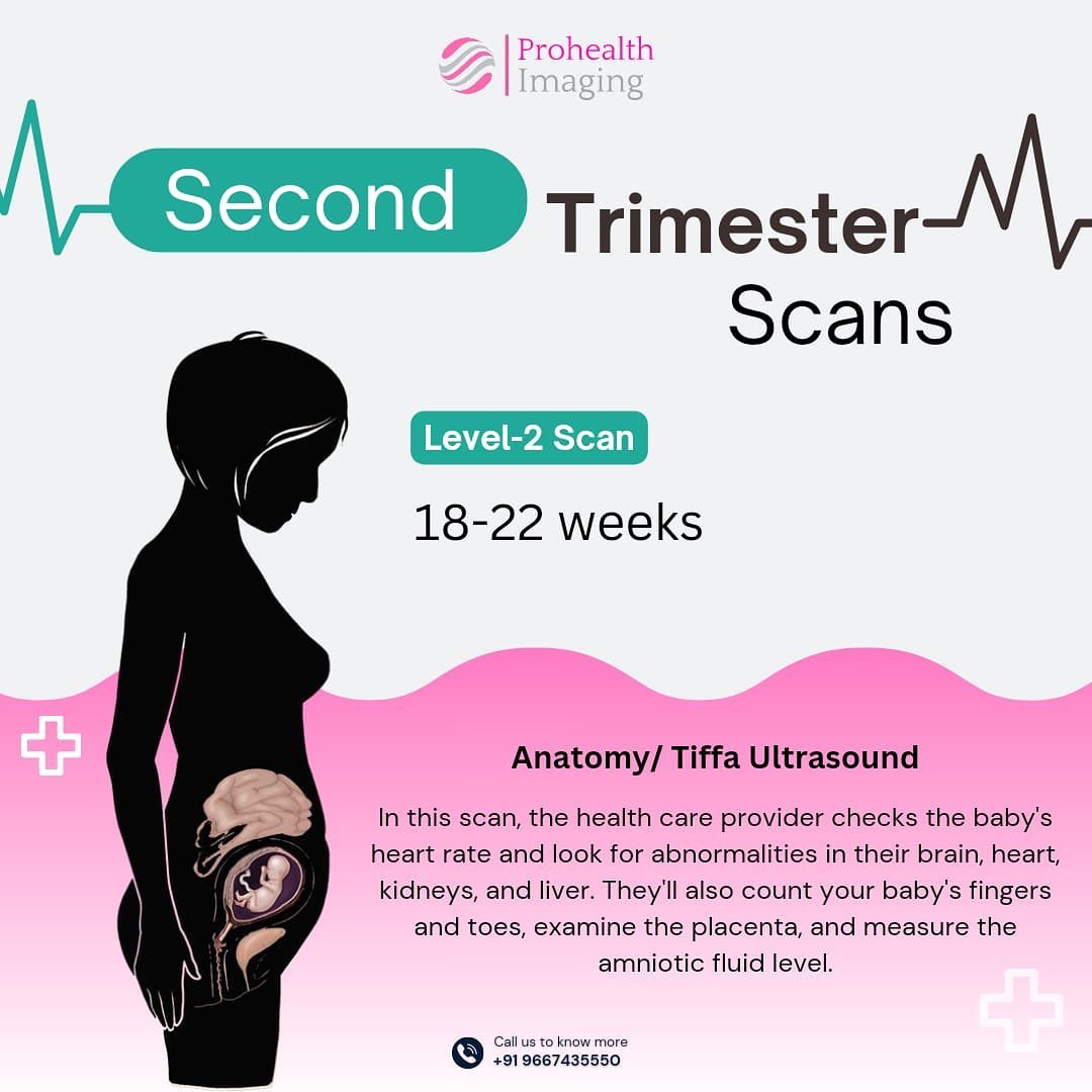 The second semester ultrasound or The... - Prohealth Imaging | Facebook