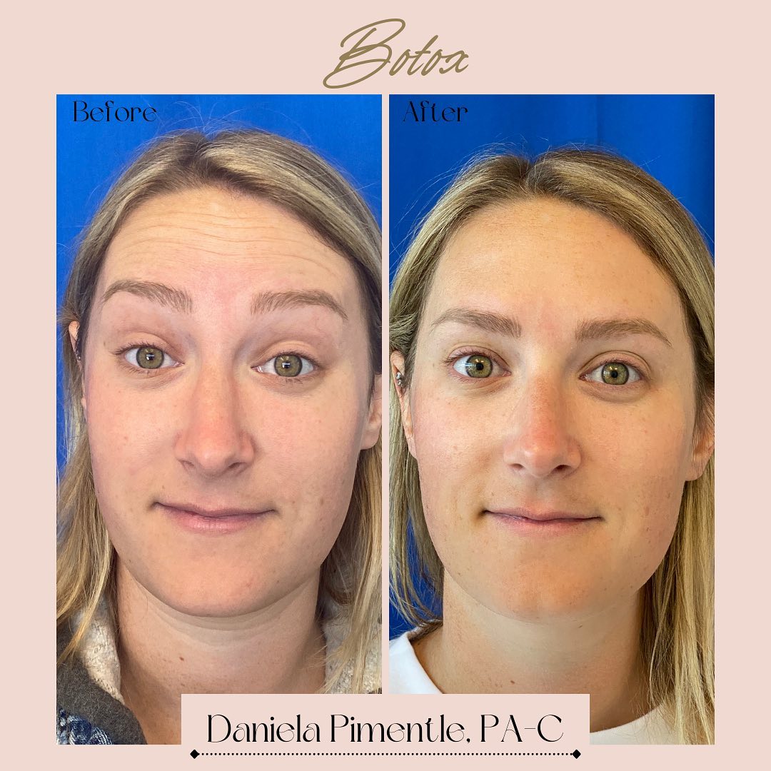 Rox Spa Newport Beach | Newport Beach CA