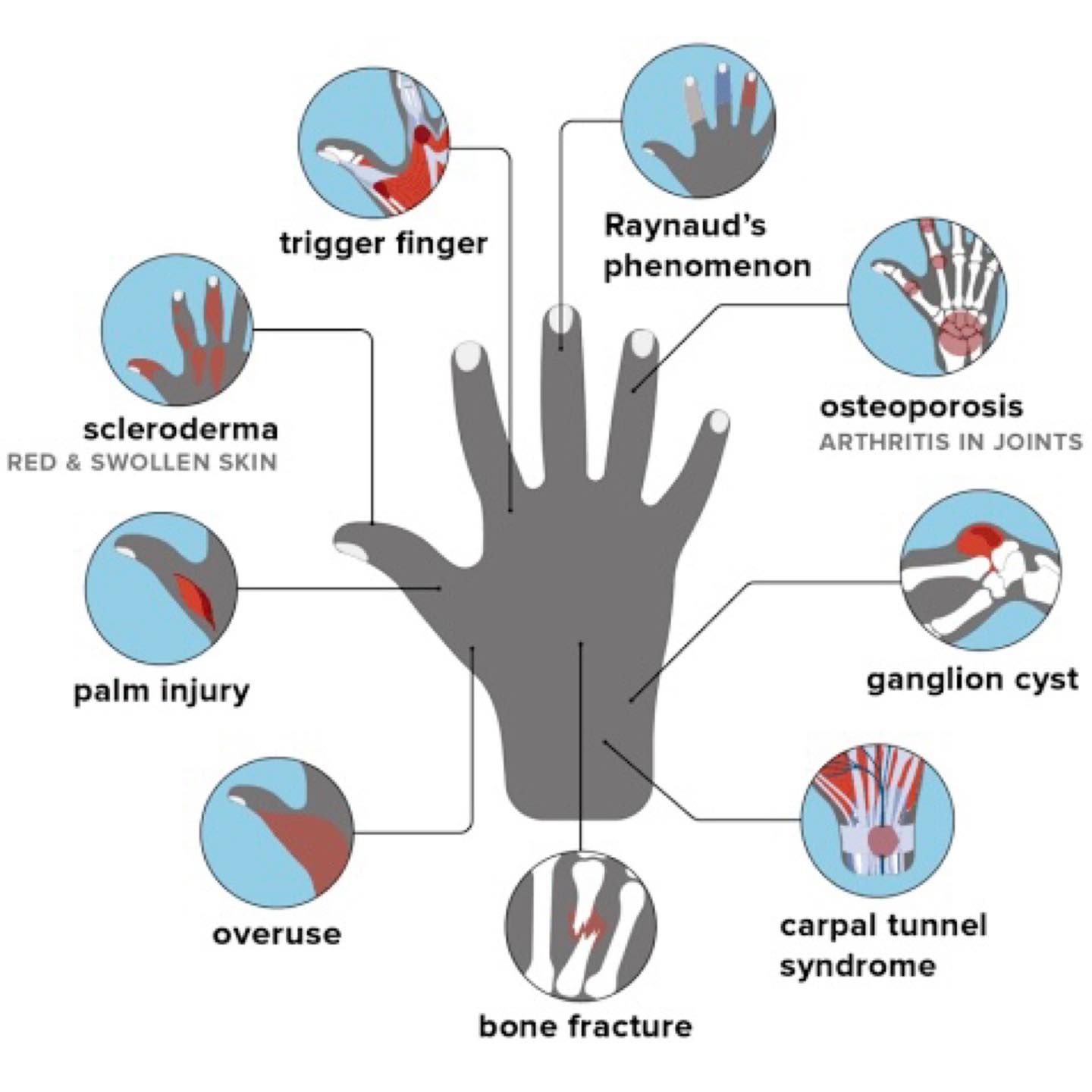 PhysioOsteoBook - Hand Pain 🖐️⚡️