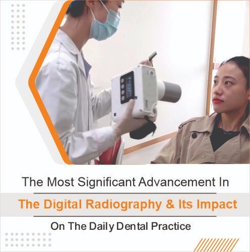 Unicorn Denmart Ltd. - How digital radiography can help you in accurate ...