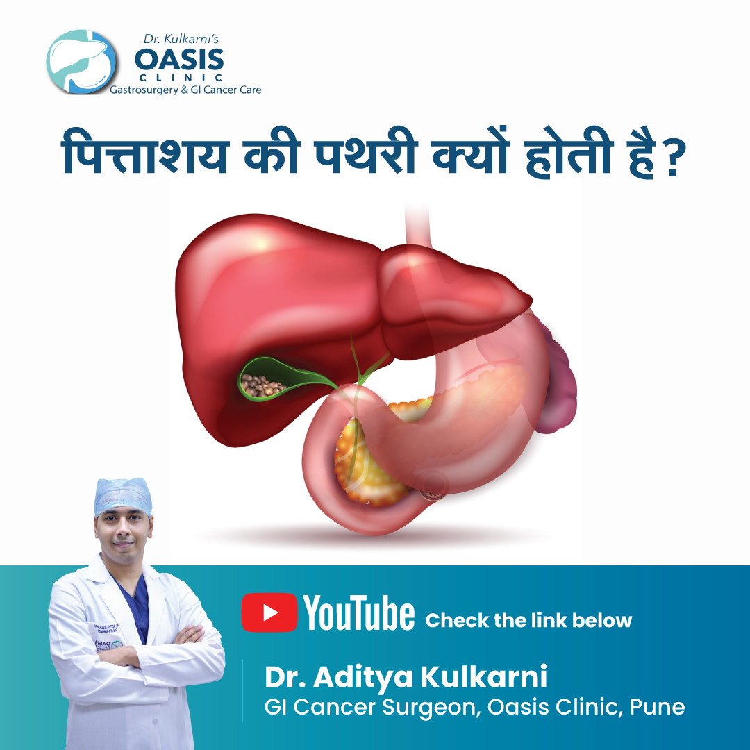 Dr. Aditya Kulkarni Robotic Laparoscopic Gastrointestinal & Cancer ...