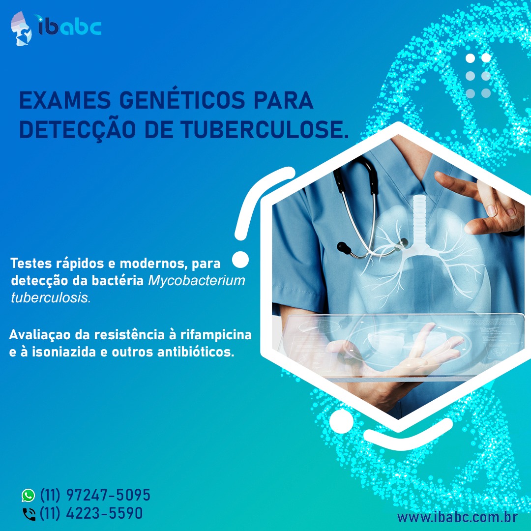 A tuberculose é uma... - IBABC - Instituto de Biomedicina
