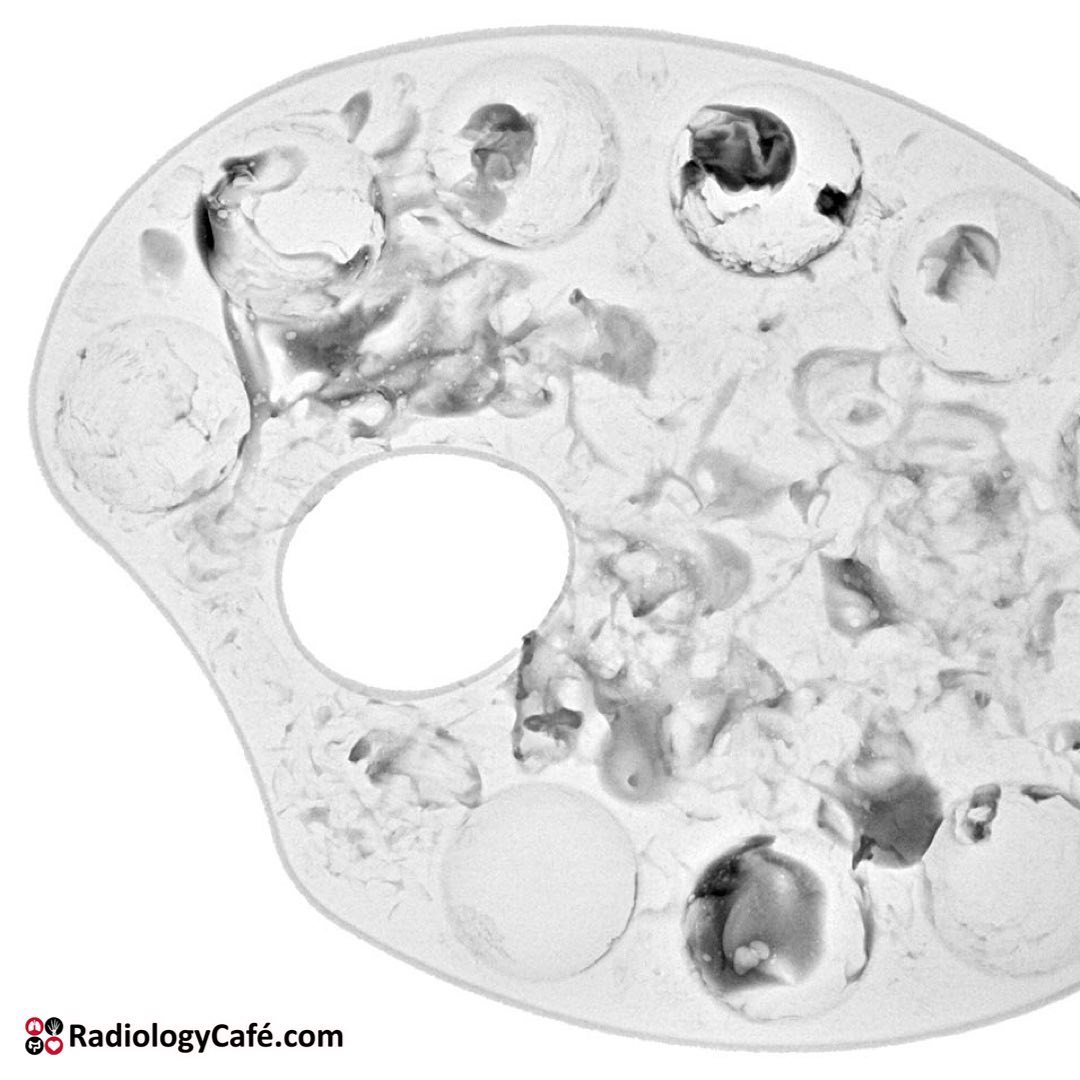 Radiology Cafe