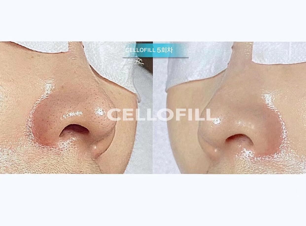 귀티나는 물광피부는 모든 여자들의 꿈이죠? 꾸준히 관리를... - Cellofillofficial | Facebook