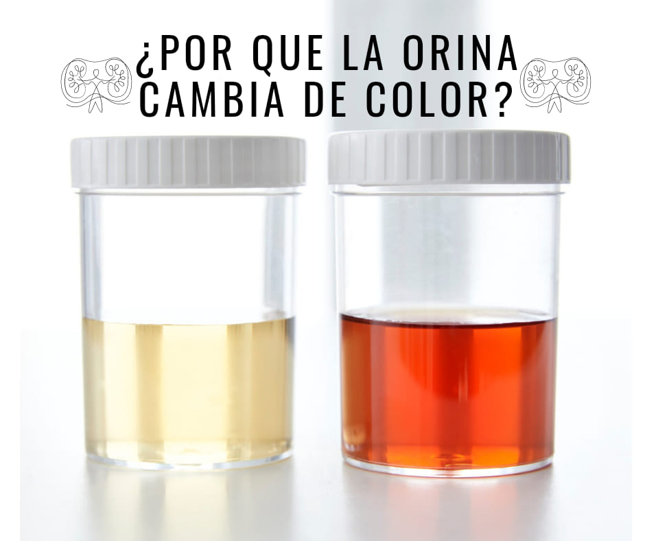 Dr. - ⚠️ EL COLOR DE TU ORINA ⚠️ ¿Es normal orinar de diferentes ...