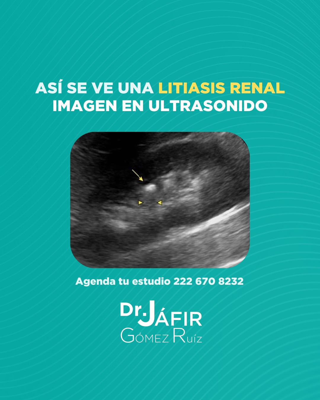 👉 En la exploración del riñón, las... - Dr. Jáfir Gómez Ruíz | Facebook