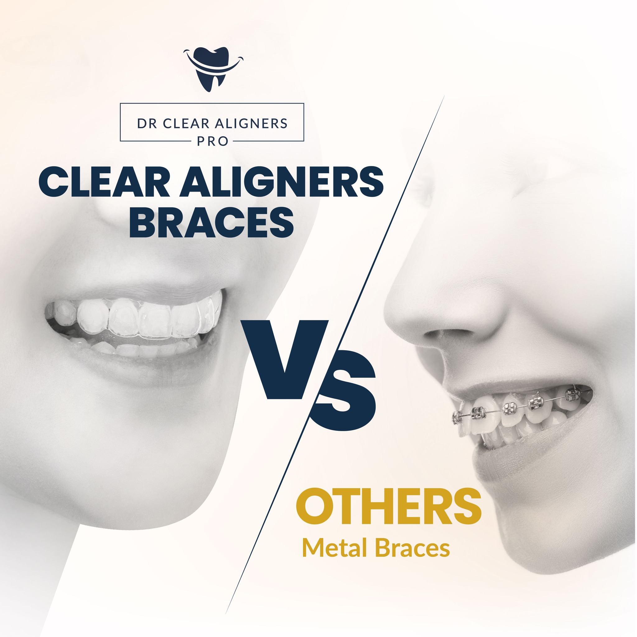 Dr Clear Aligners Pro