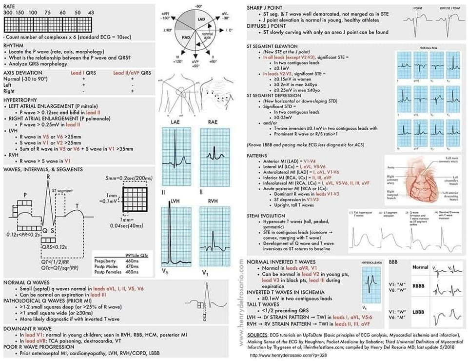 House of Medical Skills and Knowledge with Dr IsraelGi - #ECG ECG ...