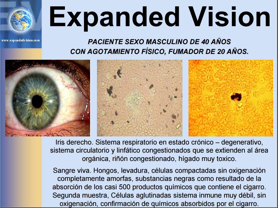 Expanded Vision Group Corp Sur America | Villavicencio