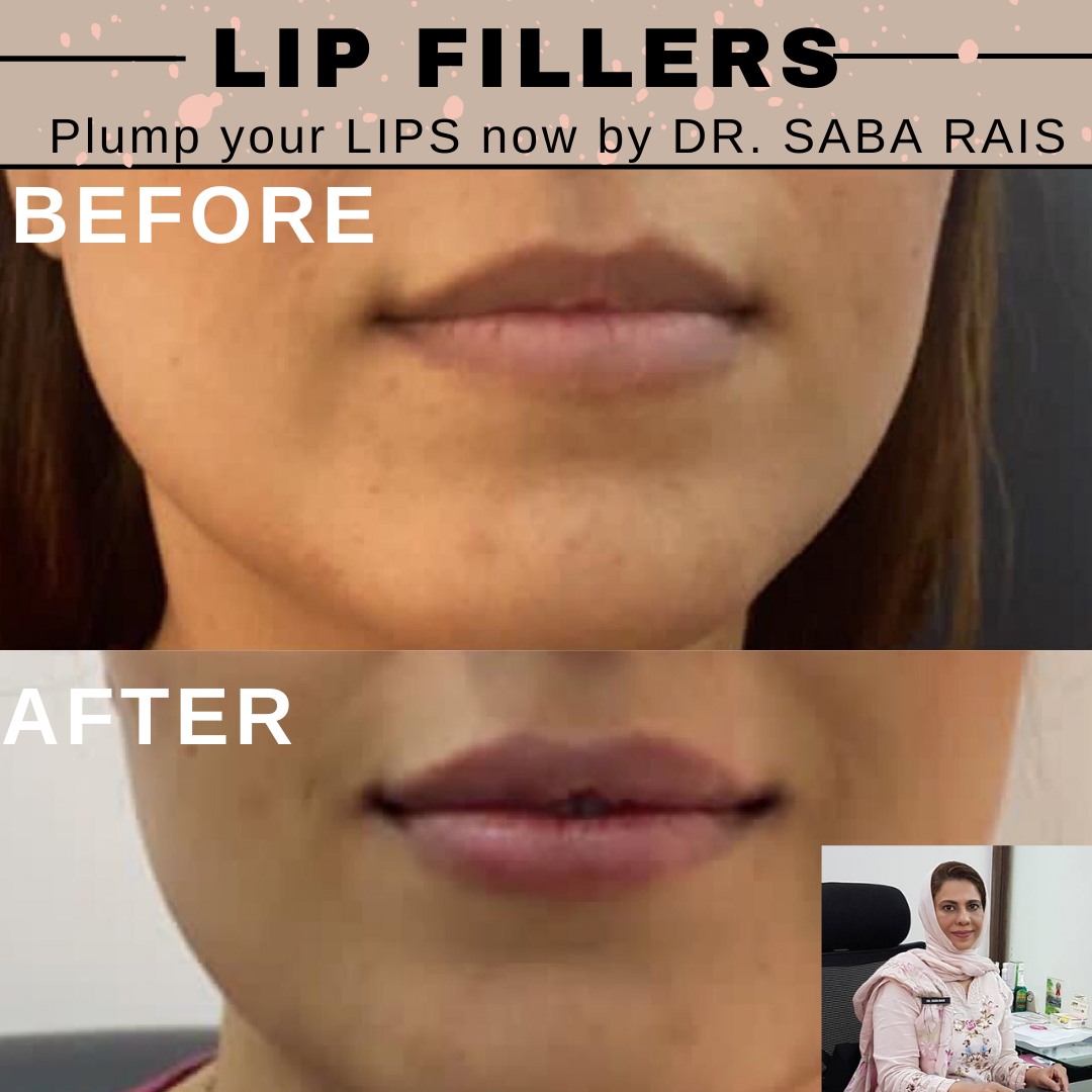 Dr. Saba Rais | Doha