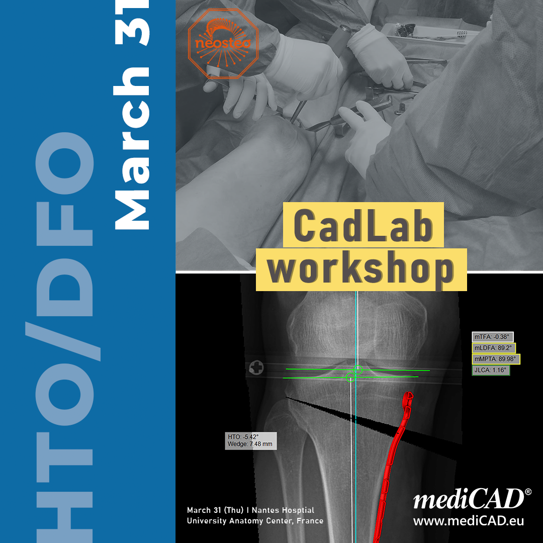 🗓️ Save your date - March 31st We... - mediCAD Hectec GmbH