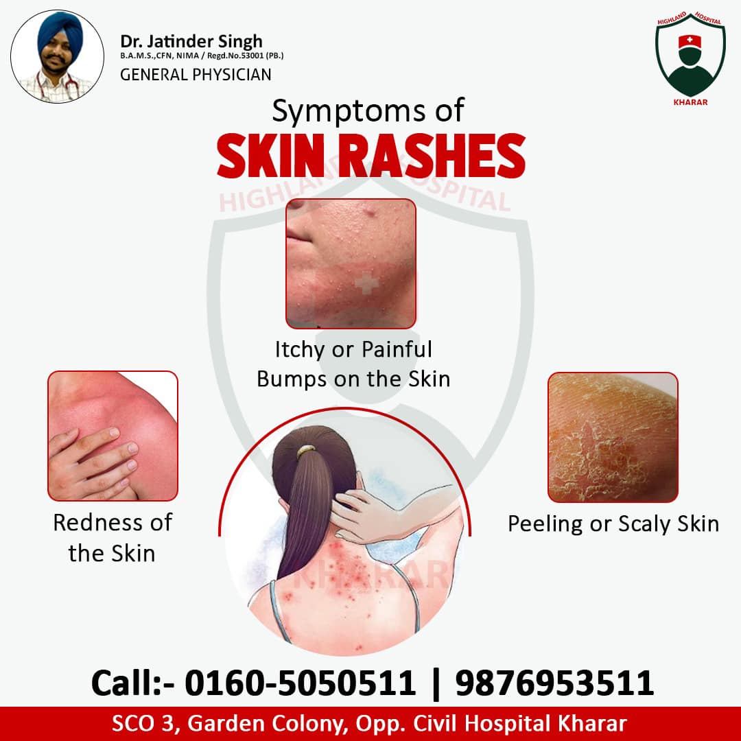 Symptoms of Skin Rashes 🔹 Redness of... - dr_jatinder_singh | Facebook