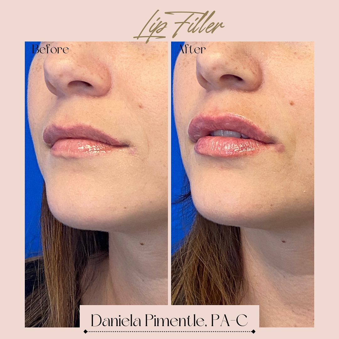 Rox Spa Newport Beach | Newport Beach CA